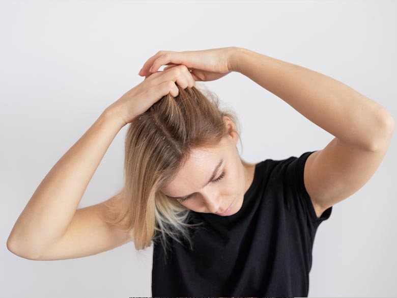 cuero cabelludo cuero cabelludo